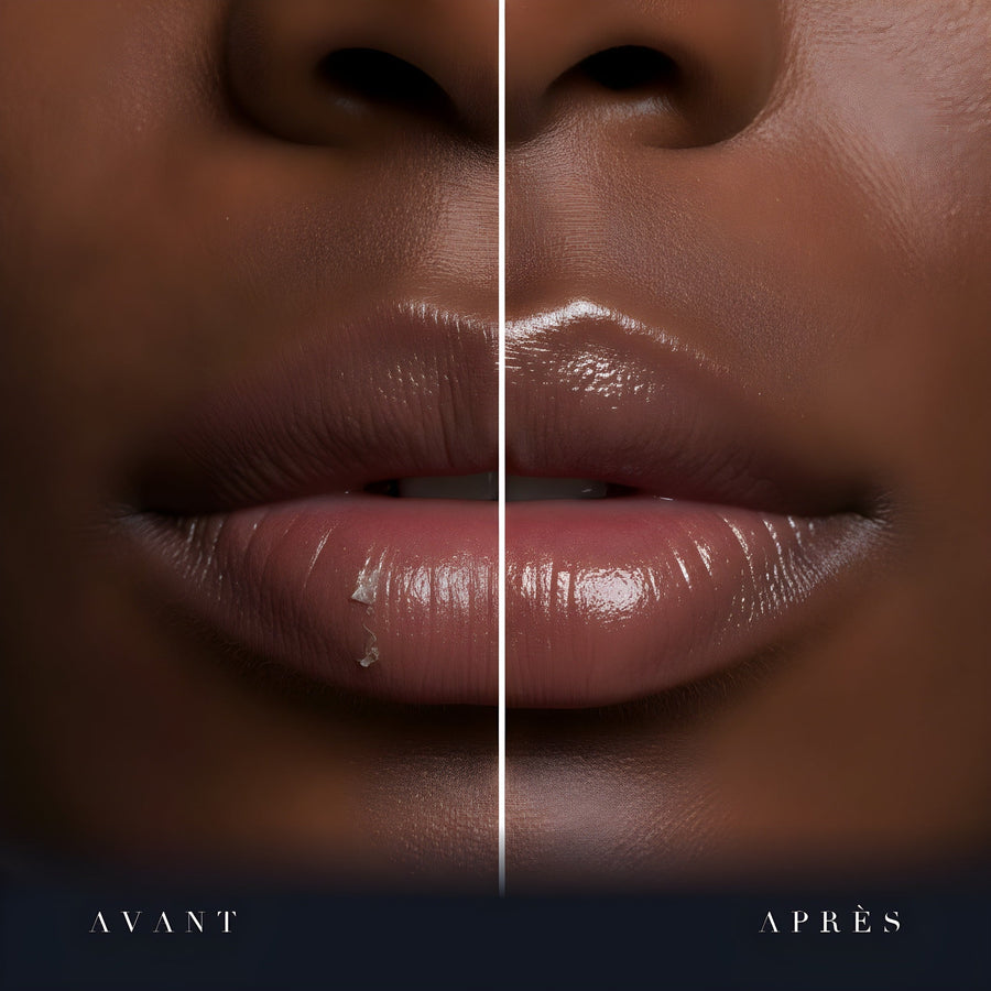 Avant après au coin de la bouche